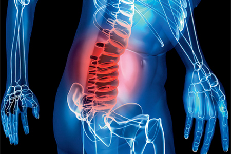 Pain in the Back Pain in the Back