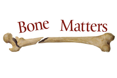Bone Matters Bone Matters